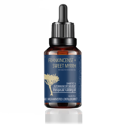 (CASE OF 8) Frankincense & Sweet Myrrh Infused Therapeutic Rubbing Oil, 2 Fl Oz